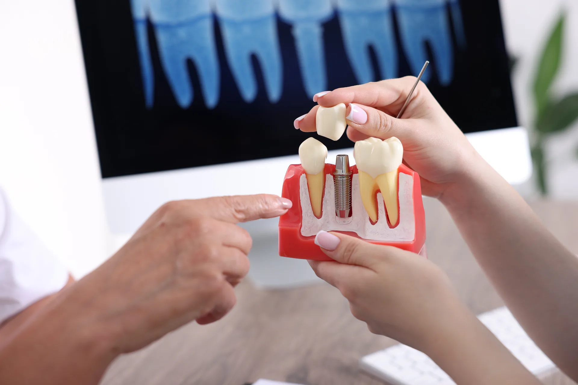 Dental implant hero background